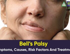 Bell’s Palsy: Causes, Risk Factors, and Treatment